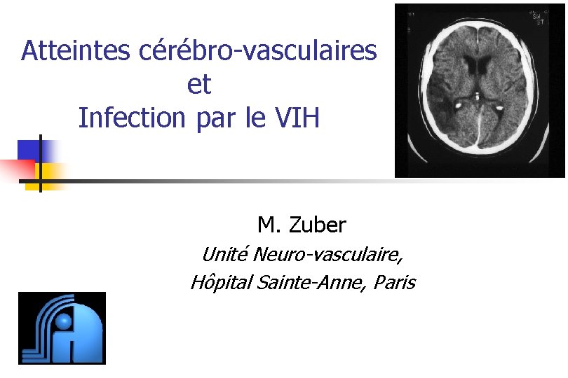 Atteintes cérébro-vasculaires et Infection par le VIH M. Zuber Unité Neuro-vasculaire, Hôpital Sainte-Anne, Paris