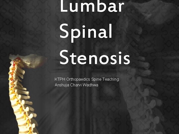 Lumbar Spinal Stenosis KTPH Orthopaedics Spine Teaching Anshuja Charvi Wadhwa 