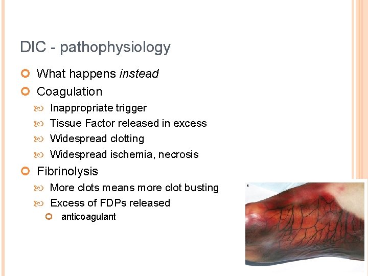 DIC - pathophysiology ¢ What happens instead ¢ Coagulation Inappropriate trigger Tissue Factor released