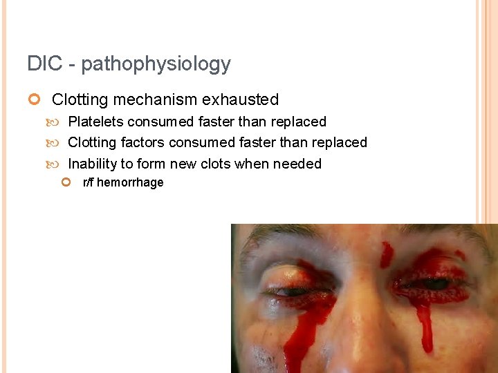 DIC - pathophysiology ¢ Clotting mechanism exhausted Platelets consumed faster than replaced Clotting factors