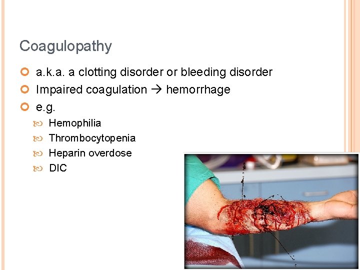 Coagulopathy ¢ a. k. a. a clotting disorder or bleeding disorder ¢ Impaired coagulation