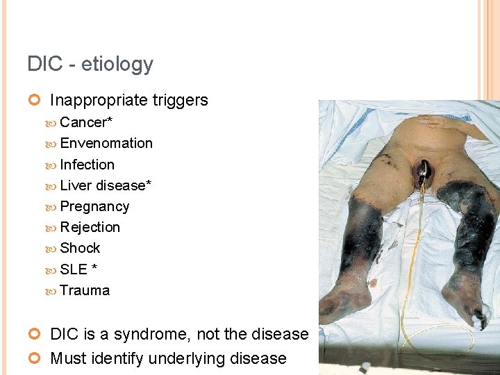 DIC - etiology ¢ Inappropriate triggers Cancer* Envenomation Infection Liver disease* Pregnancy Rejection Shock