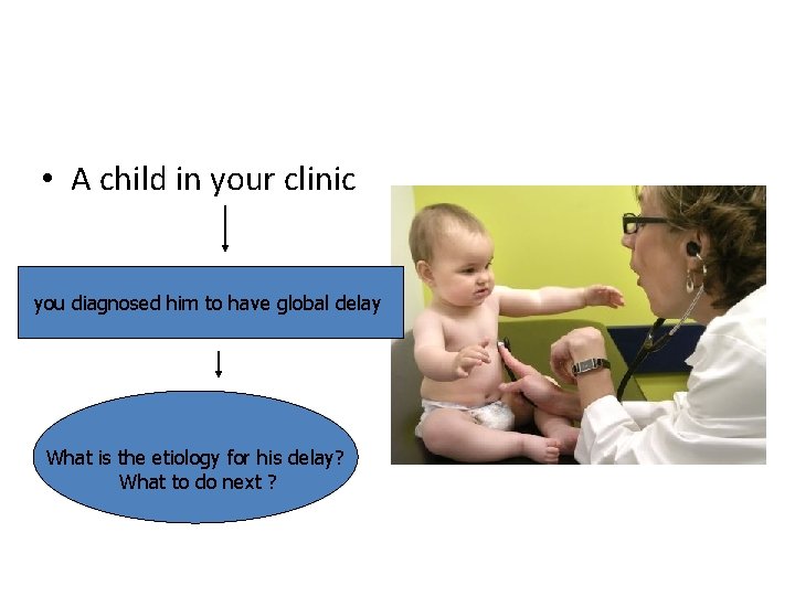  • A child in your clinic you diagnosed him to have global delay