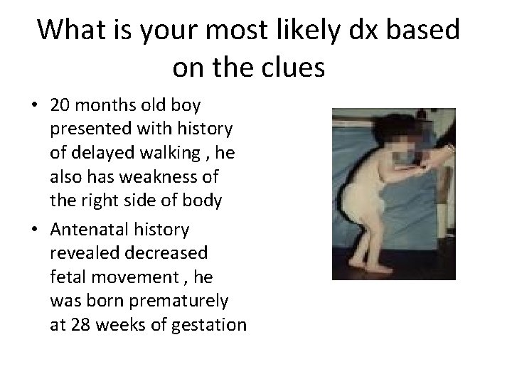 What is your most likely dx based on the clues • 20 months old