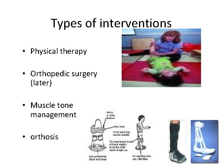 Types of interventions • Physical therapy • Orthopedic surgery (later) • Muscle tone management