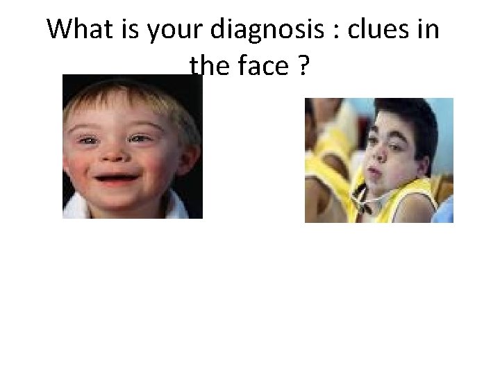 What is your diagnosis : clues in the face ? 