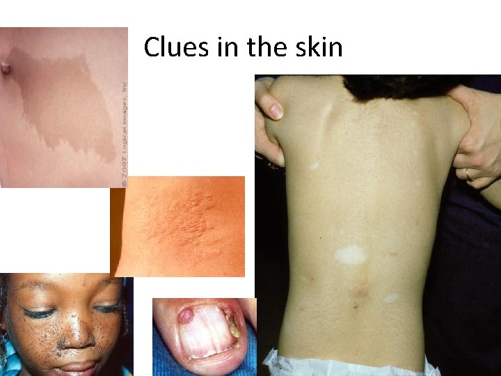 Clues in the skin 
