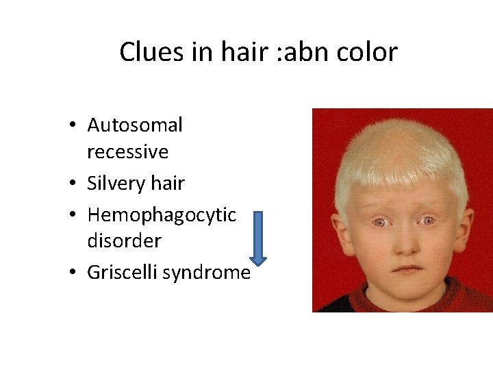 Clues in hair : abn color • Autosomal recessive • Silvery hair • Hemophagocytic
