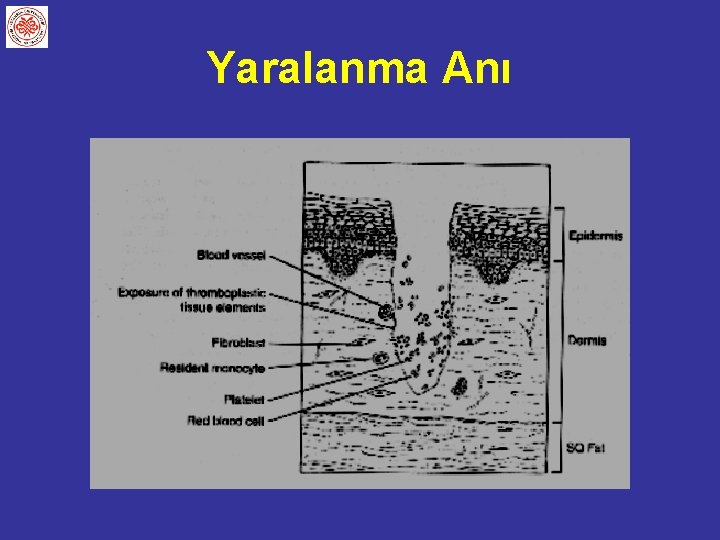 Yaralanma Anı 