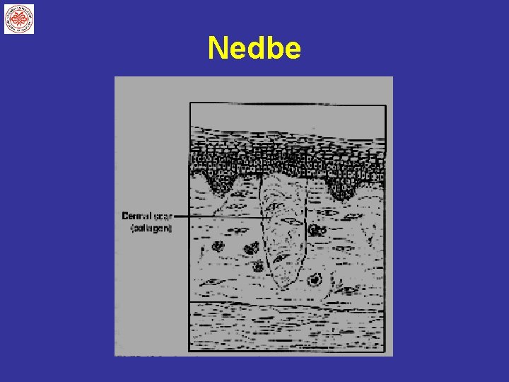 Nedbe 