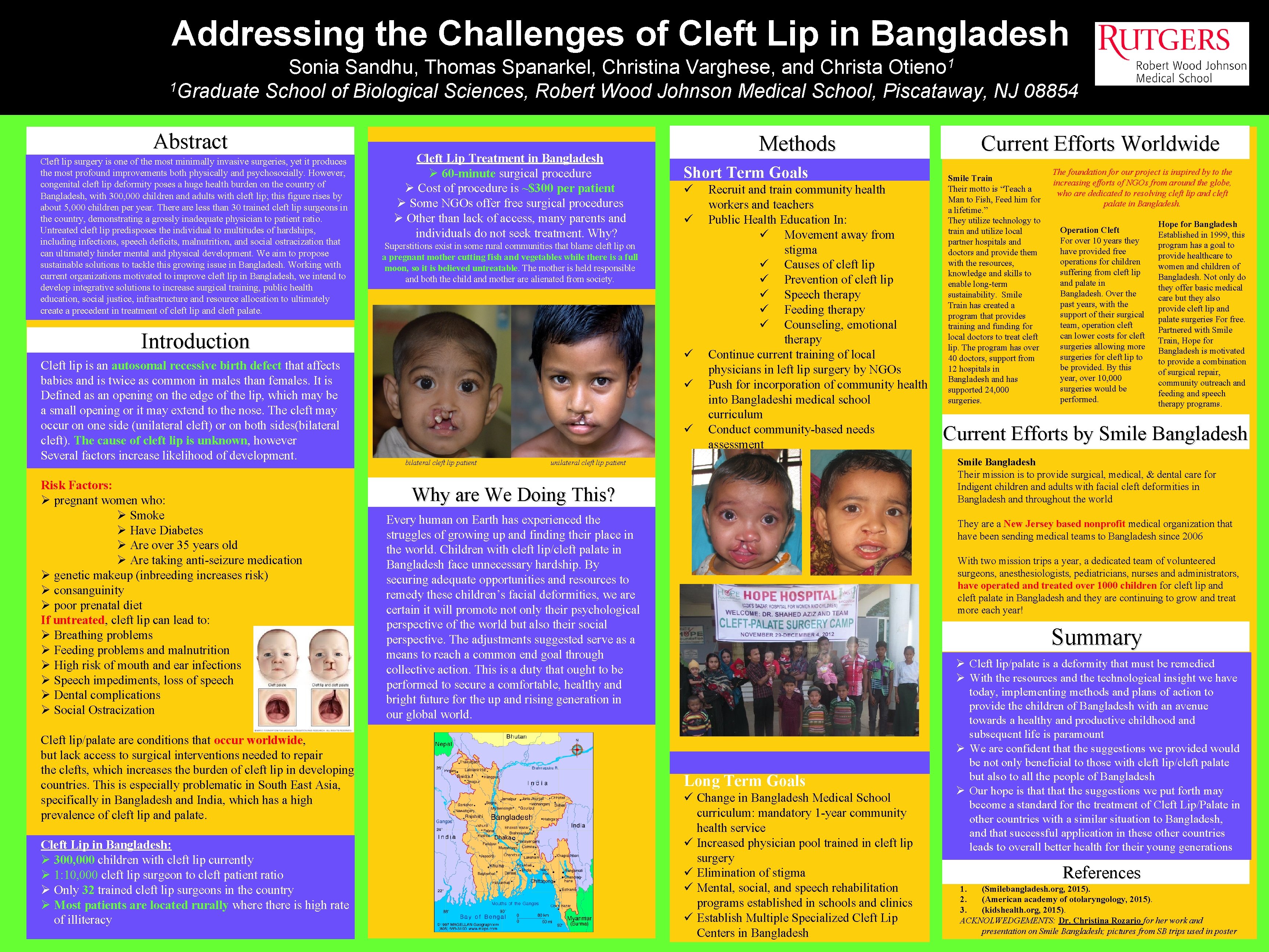 Addressing the Challenges of Cleft Lip in Bangladesh 1 Otieno Sonia Sandhu, Thomas Spanarkel,