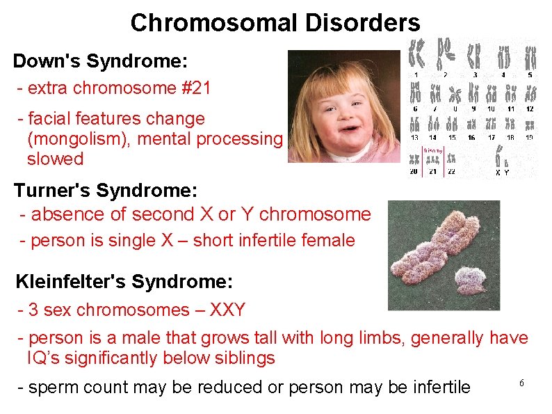 Chromosomal Disorders Down's Syndrome: - extra chromosome #21 - facial features change (mongolism), mental