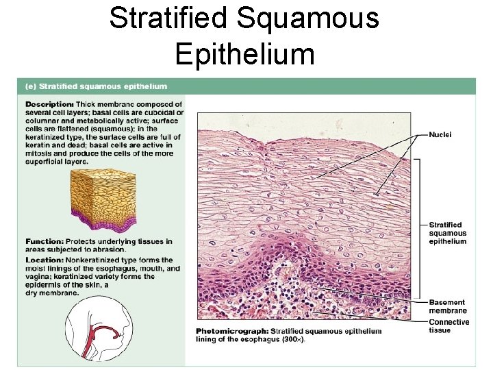 Stratified Squamous Epithelium Figure 4. 3 e 