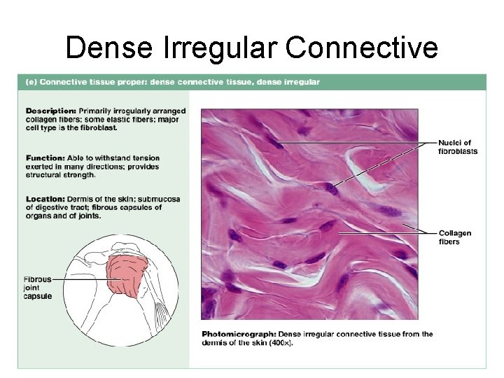 Dense Irregular Connective Tissue Figure 4. 12 e 