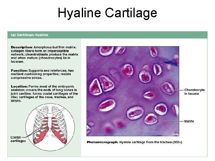 Hyaline Cartilage Figure 4. 12 g 