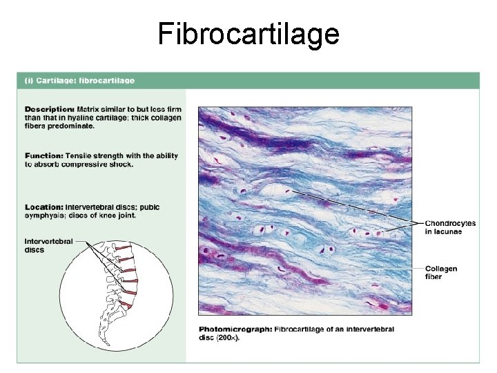 Fibrocartilage Figure 4. 12 i 