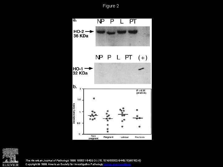 Figure 2 The American Journal of Pathology 1999 155831 -840 DOI: (10. 1016/S 0002