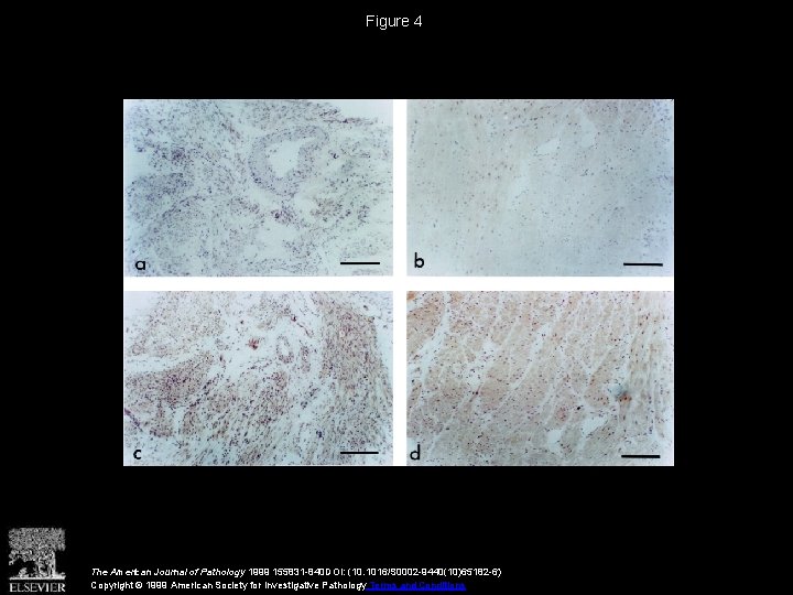 Figure 4 The American Journal of Pathology 1999 155831 -840 DOI: (10. 1016/S 0002