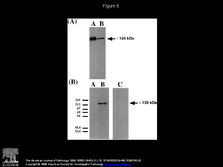 Figure 5 The American Journal of Pathology 1999 155831 -840 DOI: (10. 1016/S 0002