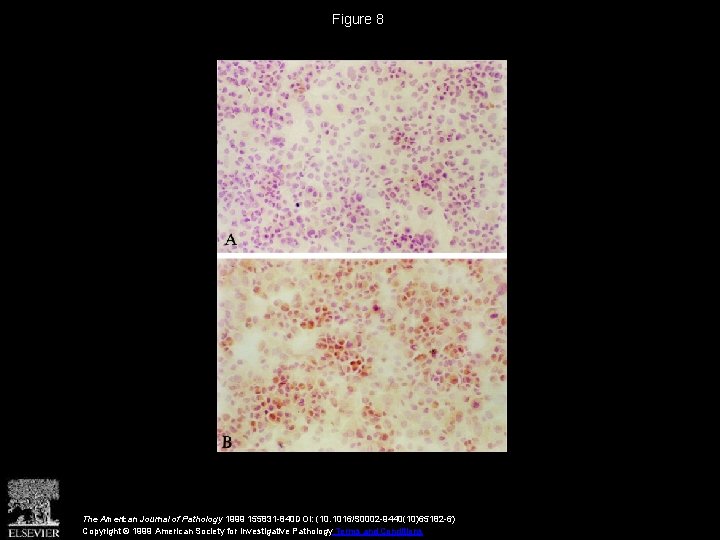 Figure 8 The American Journal of Pathology 1999 155831 -840 DOI: (10. 1016/S 0002