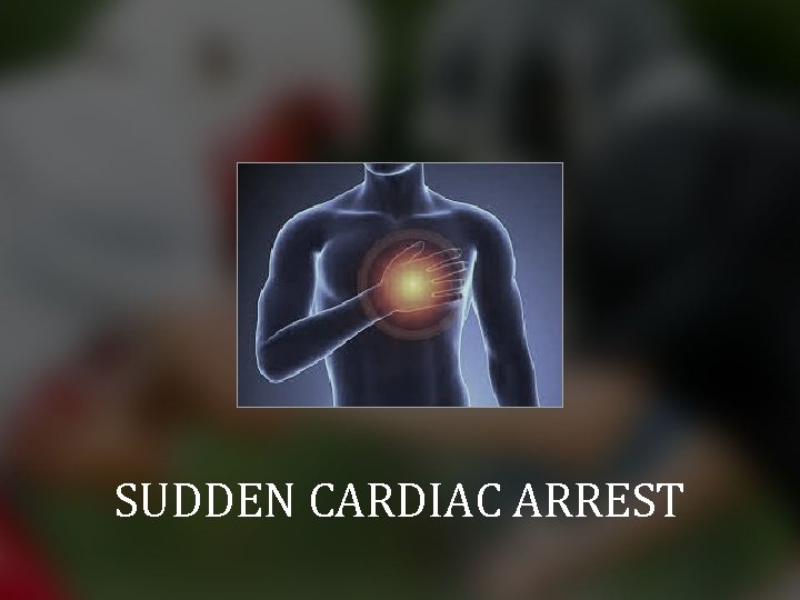 SUDDEN CARDIAC ARREST 