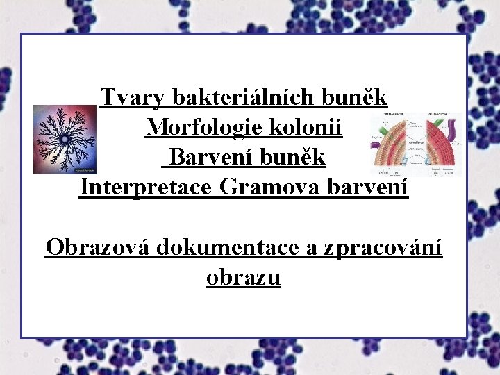 Tvary bakteriálních buněk Morfologie kolonií Barvení buněk Interpretace Gramova barvení Obrazová dokumentace a zpracování