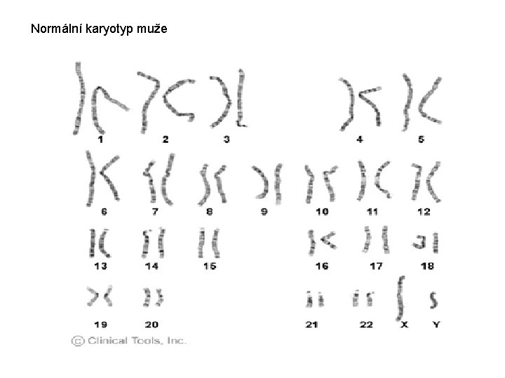 Normální karyotyp muže 
