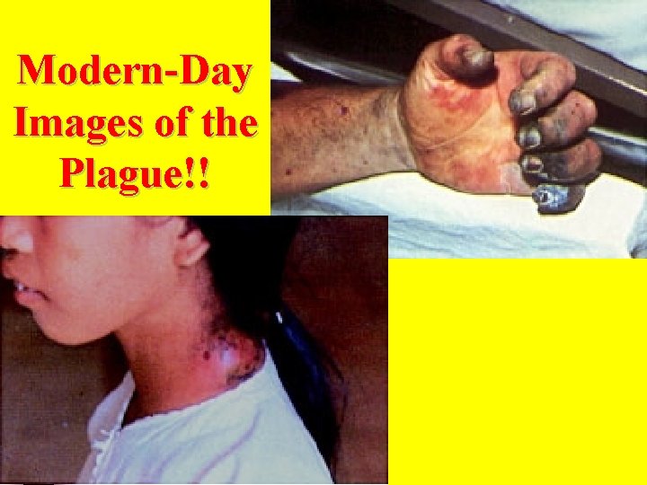 Modern-Day Images of the Plague!! 