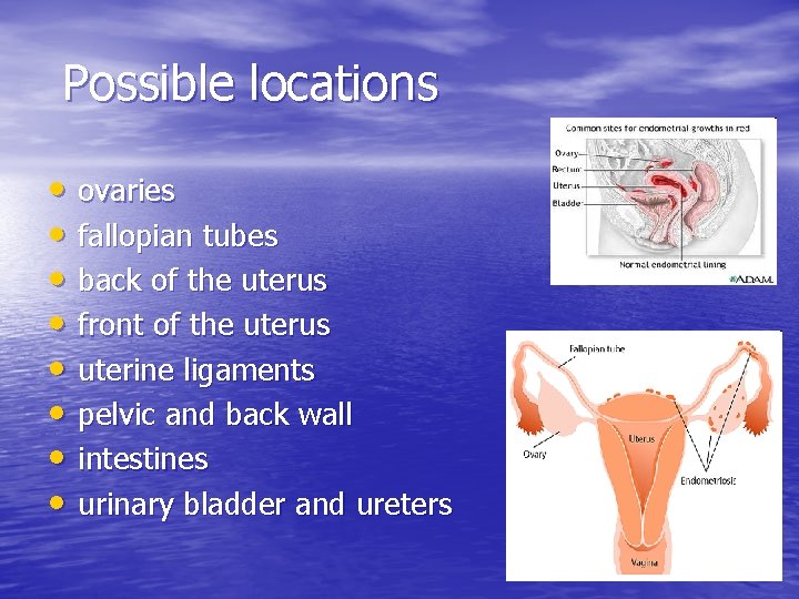 Possible locations • ovaries • fallopian tubes • back of the uterus • front