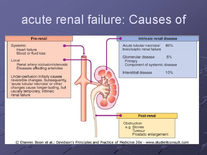 acute renal failure: Causes of 