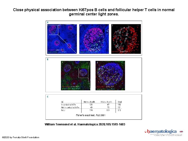 Close physical association between Ki 67 pos B cells and follicular helper T cells