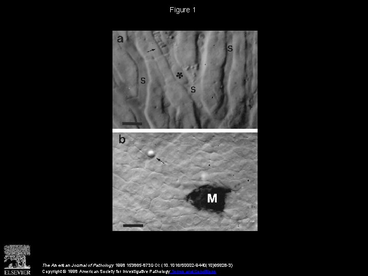 Figure 1 The American Journal of Pathology 1998 153865 -873 DOI: (10. 1016/S 0002