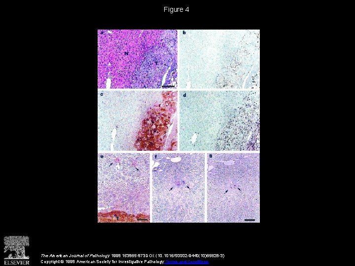 Figure 4 The American Journal of Pathology 1998 153865 -873 DOI: (10. 1016/S 0002