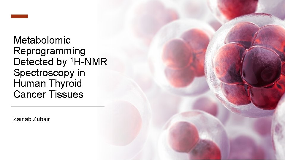 Metabolomic Reprogramming Detected by 1 H-NMR Spectroscopy in Human Thyroid Cancer Tissues Zainab Zubair