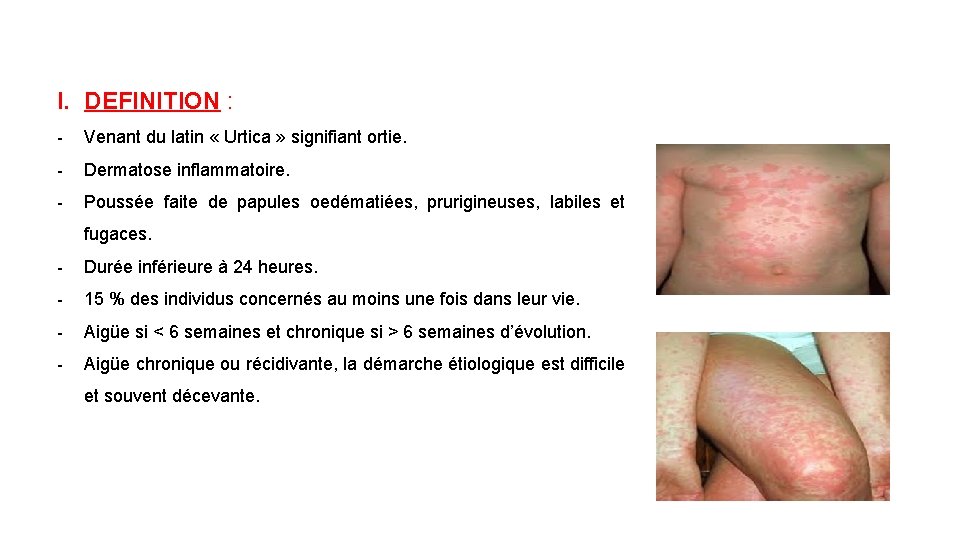 I. DEFINITION : - Venant du latin « Urtica » signifiant ortie. - Dermatose