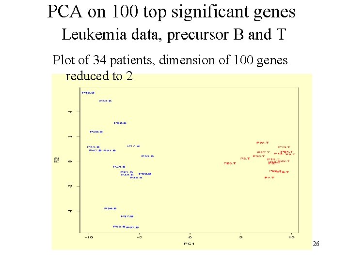 PCA on 100 top significant genes Leukemia data, precursor B and T Plot of