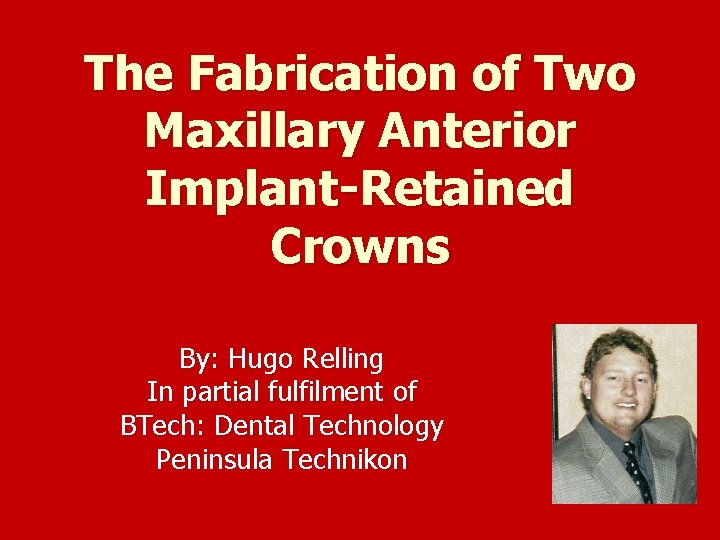 The Fabrication of Two Maxillary Anterior Implant-Retained Crowns By: Hugo Relling In partial fulfilment