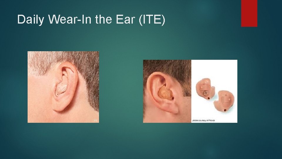 Daily Wear-In the Ear (ITE) 