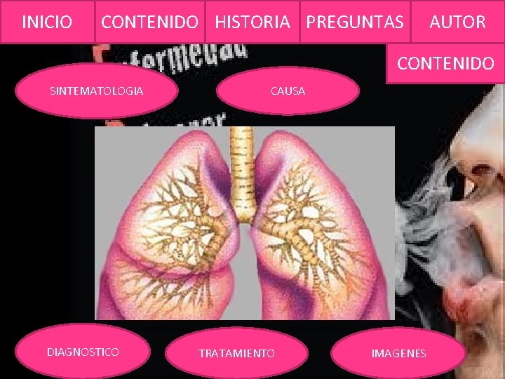 INICIO CONTENIDO HISTORIA PREGUNTAS AUTOR CONTENIDO SINTEMATOLOGIA DIAGNOSTICO CAUSA TRATAMIENTO IMAGENES 