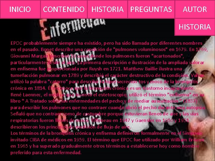 INICIO CONTENIDO HISTORIA PREGUNTAS AUTOR HISTORIA EPOC probablemente siempre ha existido, pero ha sido