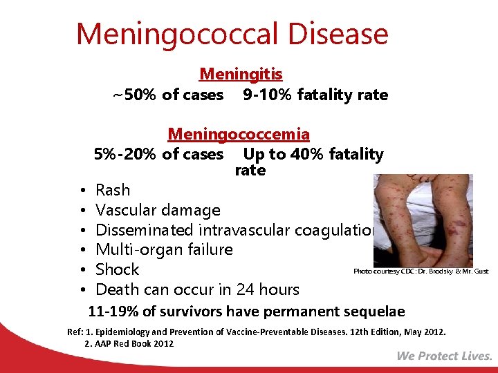 Meningococcal Disease Meningitis ~50% of cases 9 -10% fatality rate Meningococcemia 5%-20% of cases