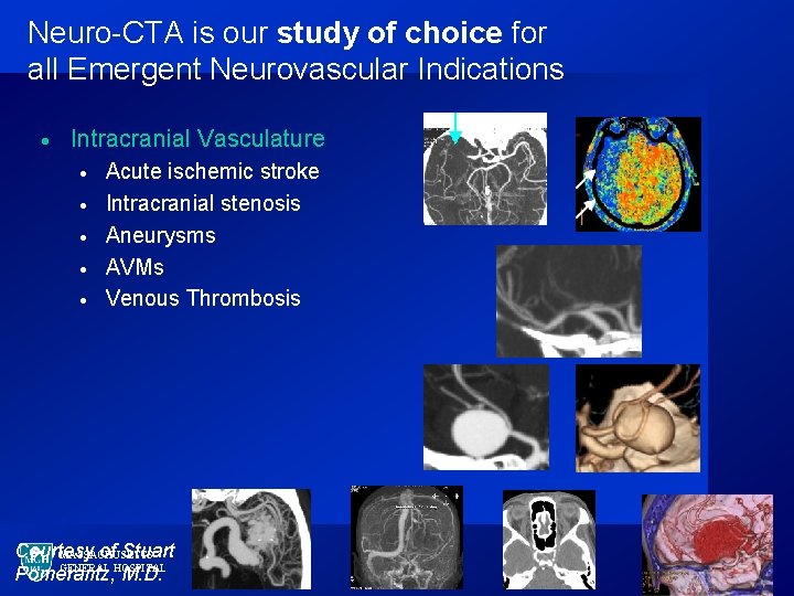 Neuro-CTA is our study of choice for all Emergent Neurovascular Indications · Intracranial Vasculature
