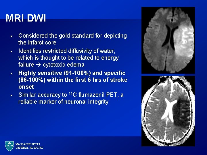MRI DWI · · Considered the gold standard for depicting the infarct core Identifies