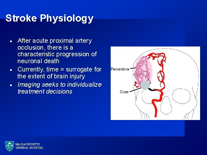 Stroke Physiology · · · After acute proximal artery occlusion, there is a characteristic