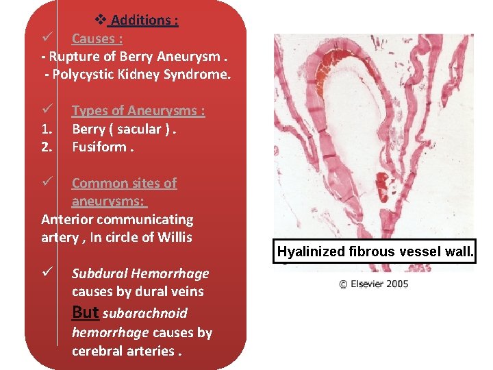 v Additions : ü Causes : - Rupture of Berry Aneurysm. - Polycystic Kidney