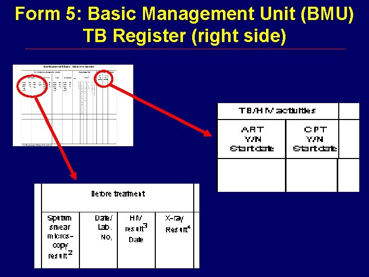 Form 5: Basic Management Unit (BMU) TB Register (right side) 