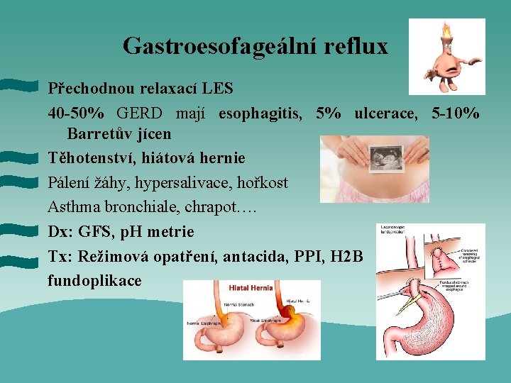 Gastroesofageální reflux Přechodnou relaxací LES 40 -50% GERD mají esophagitis, 5% ulcerace, 5 -10%