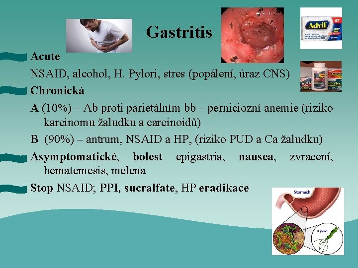 Gastritis Acute NSAID, alcohol, H. Pylori, stres (popálení, úraz CNS) Chronická A (10%) –