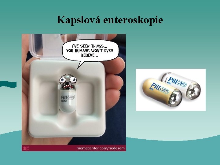 Kapslová enteroskopie 