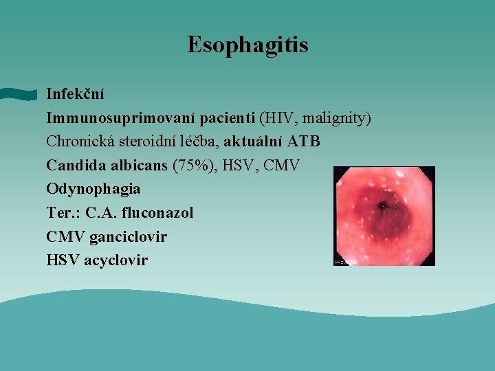 Esophagitis Infekční Immunosuprimovaní pacienti (HIV, malignity) Chronická steroidní léčba, aktuální ATB Candida albicans (75%),